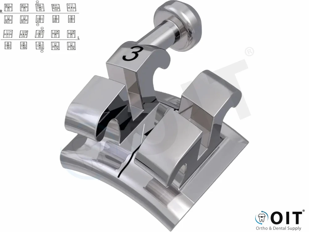 Equilibrium Ti brackets MBT 022